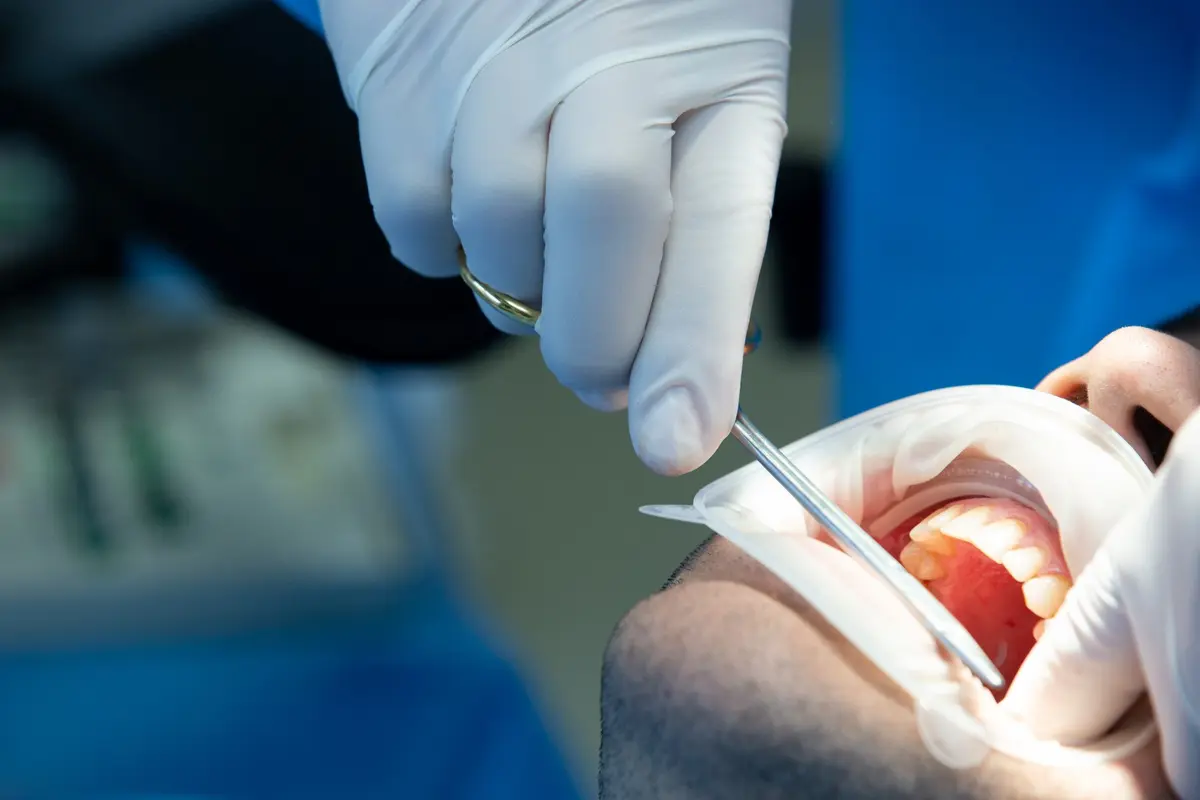 master implantología digital y cirugía oral en Madrid